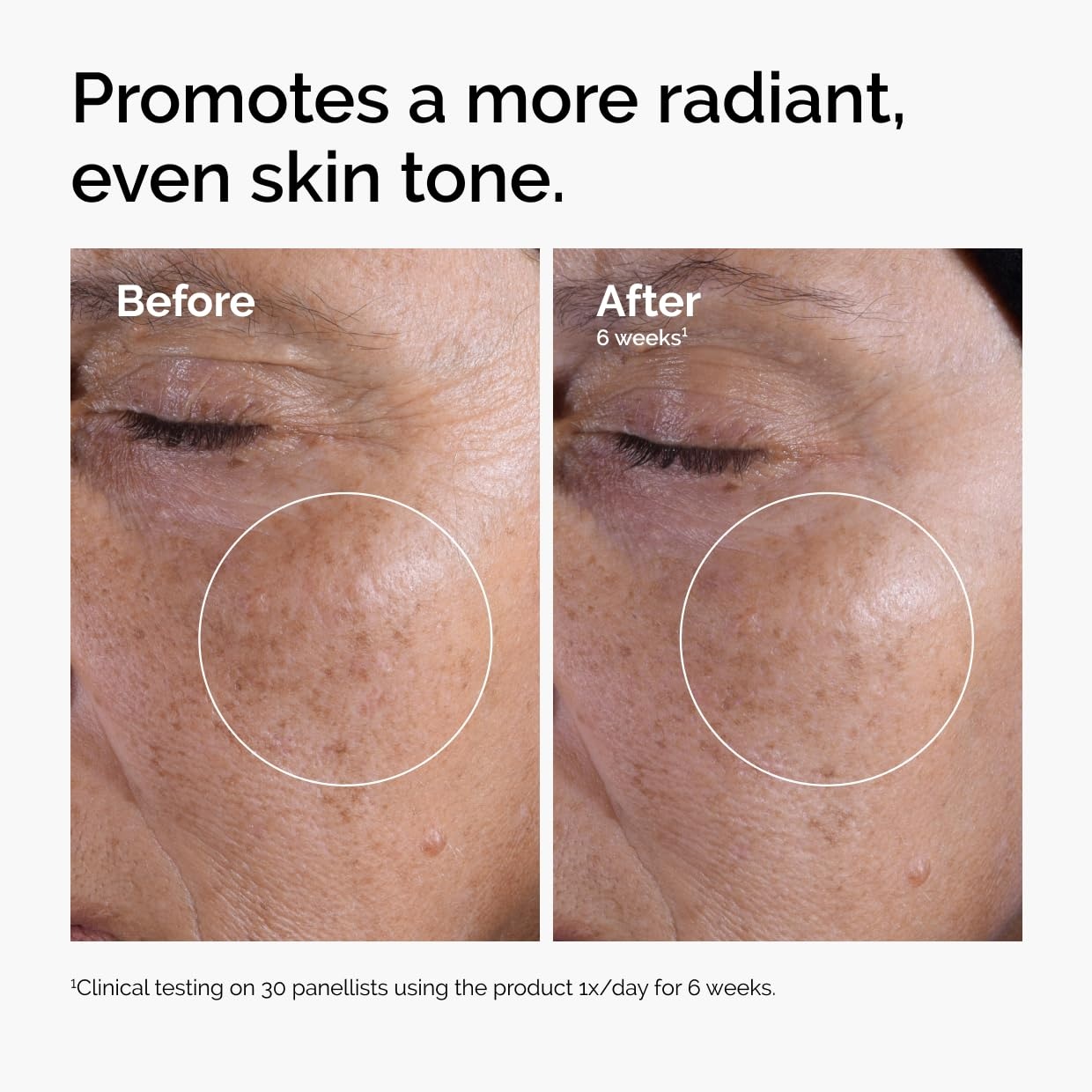 The Ordinary The Mini Icons Set, Travel Size Skin Care to Hydrate and Brighten, Glycolic Acid 7% Exfoliating Toner, Niacinamide 10% + Zinc 1%, Hyaluronic Acid 2% + B5, 4 Reusable Cotton Pads - view 4