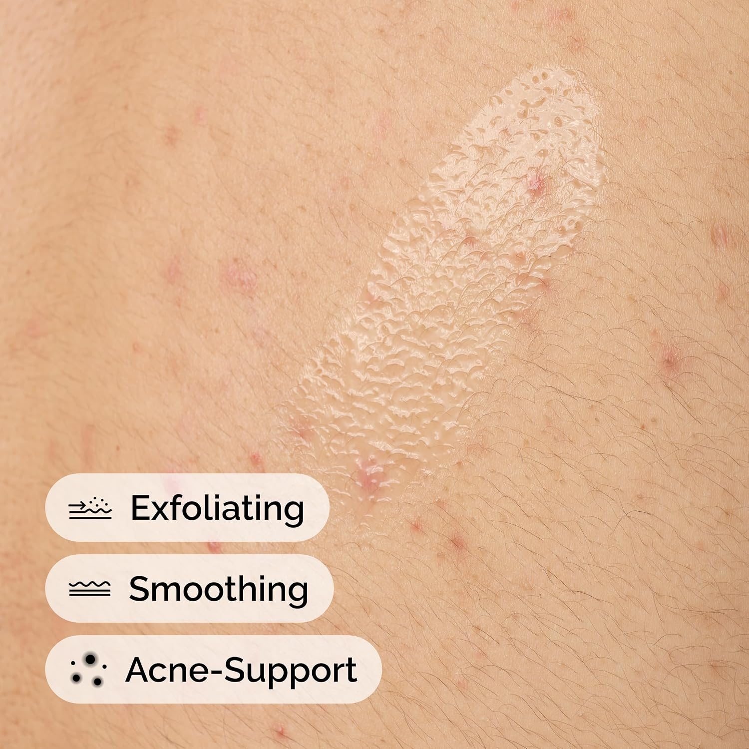 The Ordinary Salicylic Acid 0.5% Body Serum, Exfoliating Treatment for Acne-Prone Skin, 8.1 Fl Oz - view 3