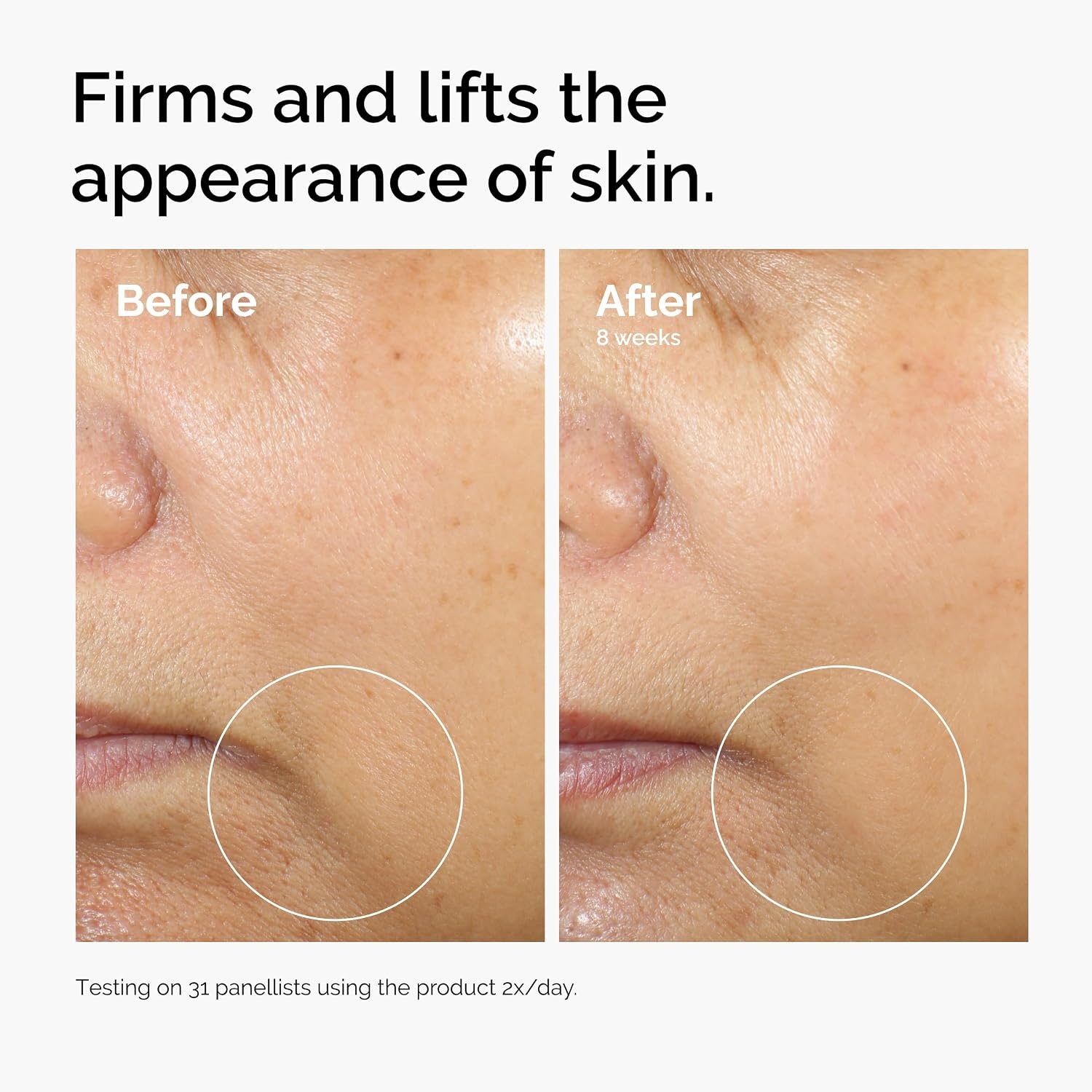 The Ordinary Caffeine 3% + Escin 1% Face Serum, Energizing Serum to Tone and Tighten, 1 Fl Oz - view 6