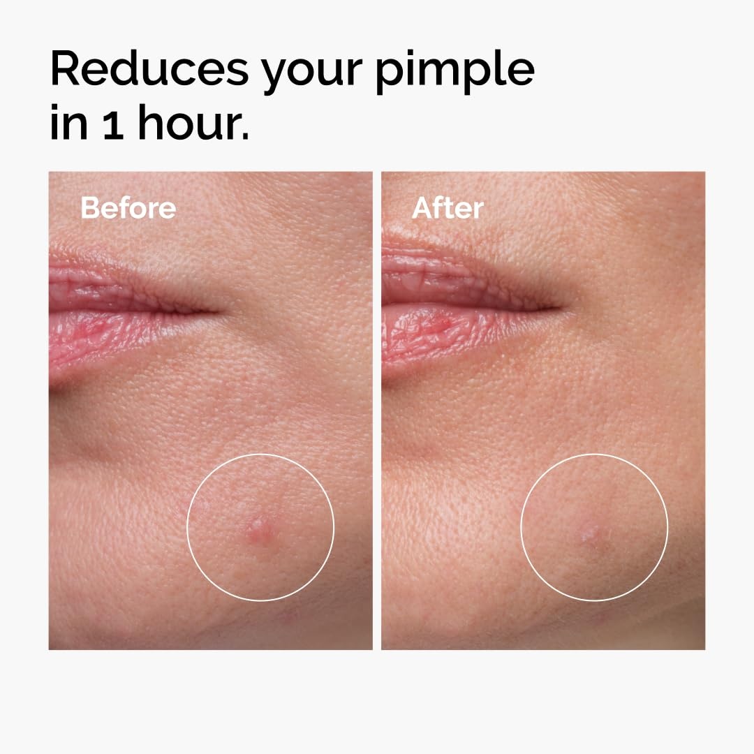 The Ordinary Oil Control Duo, Blemish Skin Care Set, Niacinamide 10% + Zinc 1% and Sulfur 10% Powder-To-Cream Concentrate - view 5