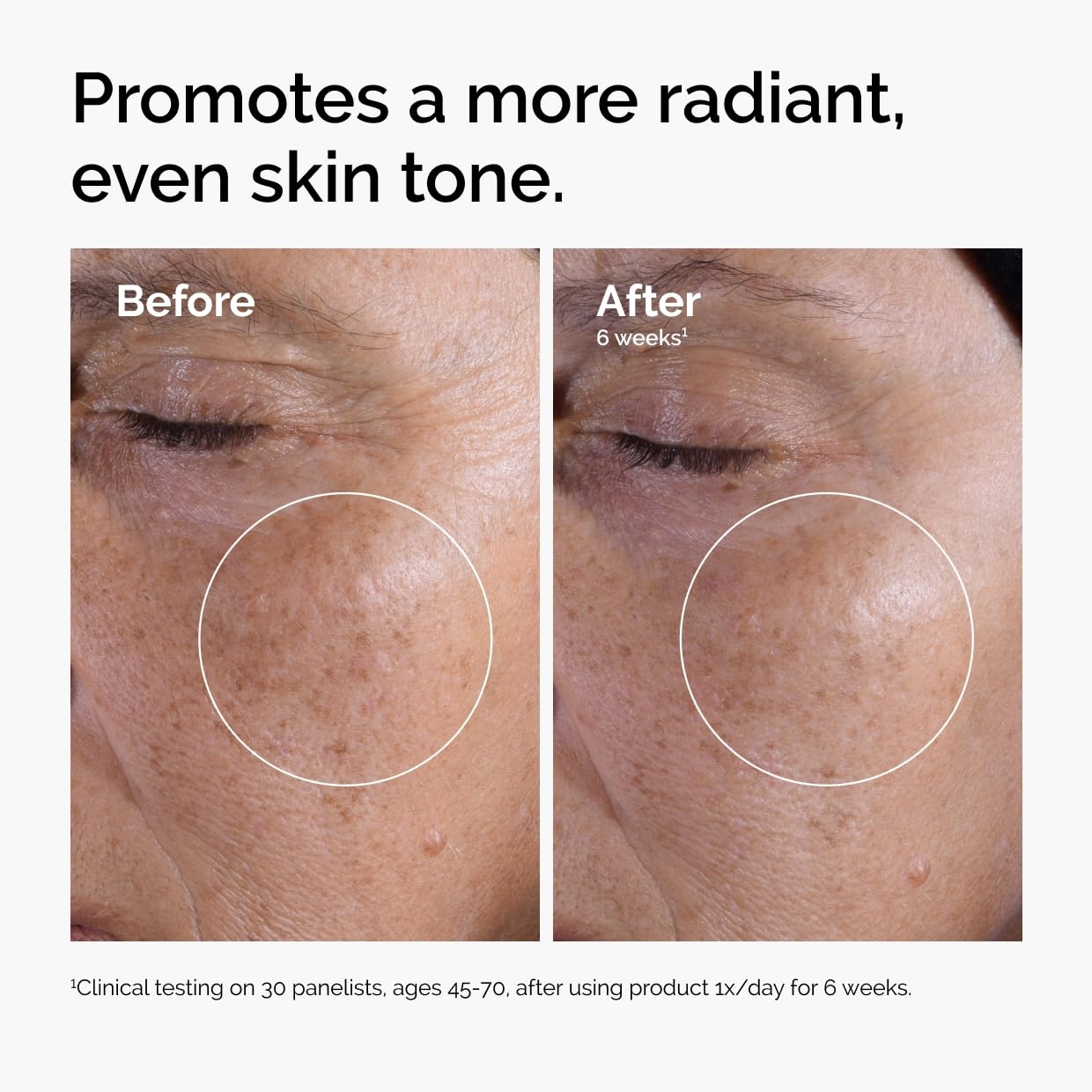The Ordinary Glycolic Acid 7% Exfoliating Toner, Brightening and Smoothing Daily Toner for More Even-Looking Skin Tone(3.4 Fl Oz (Pack of 1))