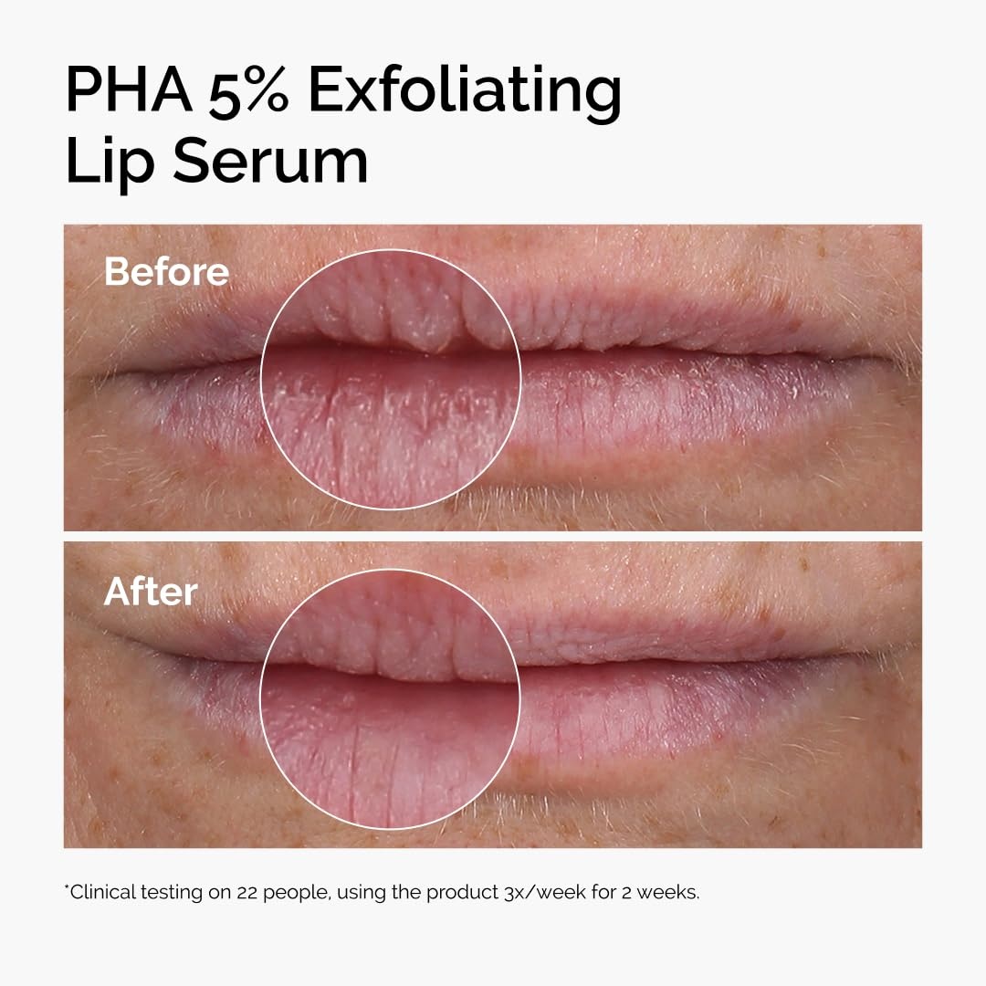 The Ordinary Lip Care Duo – Skin Care Bundle Set – PHA 5% Exfoliating Lip Serum 0.5 Fl Oz + Squalane and Amino Acids Lip Balm - view 3