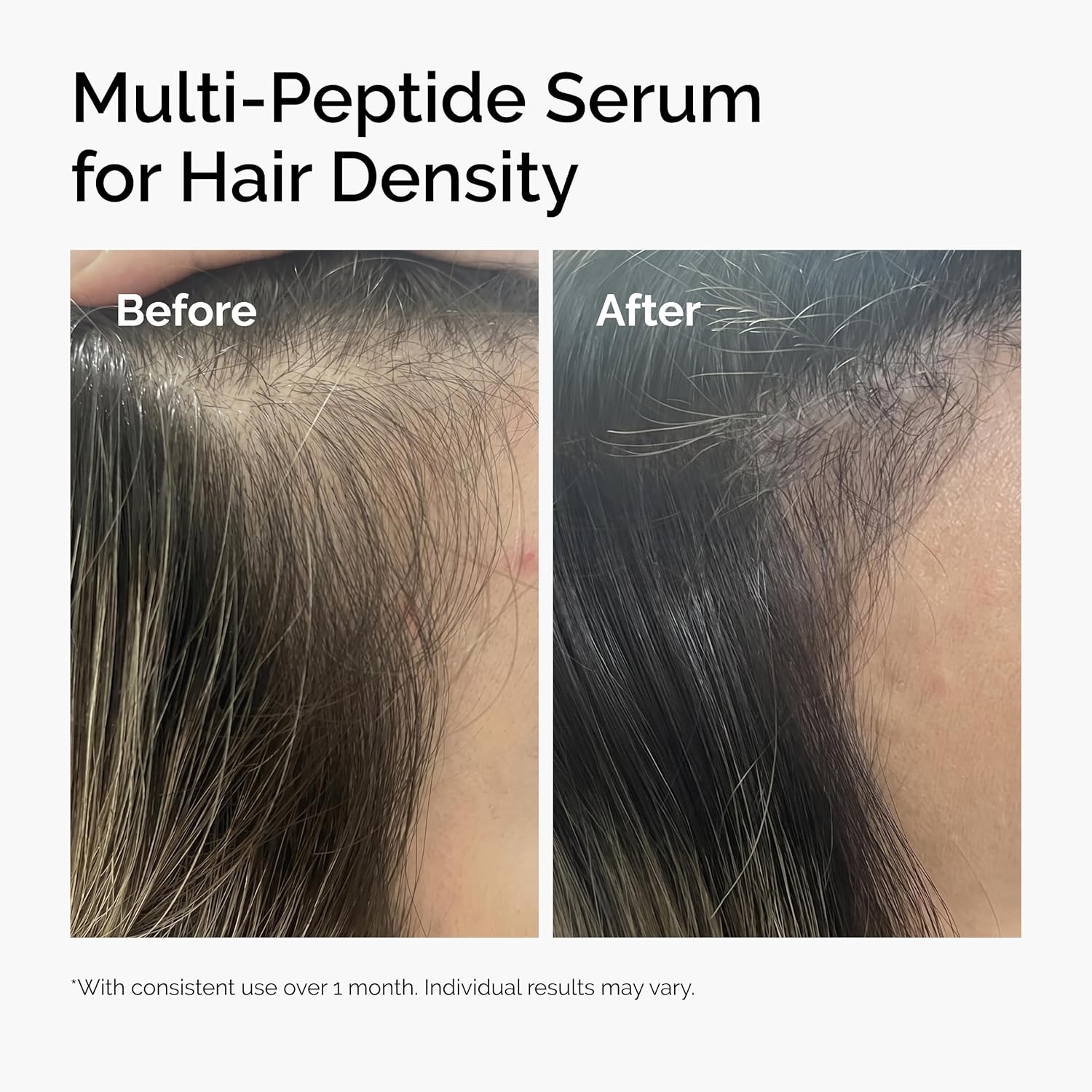 The Ordinary Multi-Peptide Serum for Hair Density, Peptide-Powered Formula for Thicker, Fuller Looking Hair(2 Fl Oz (Pack of 1)) - view 6