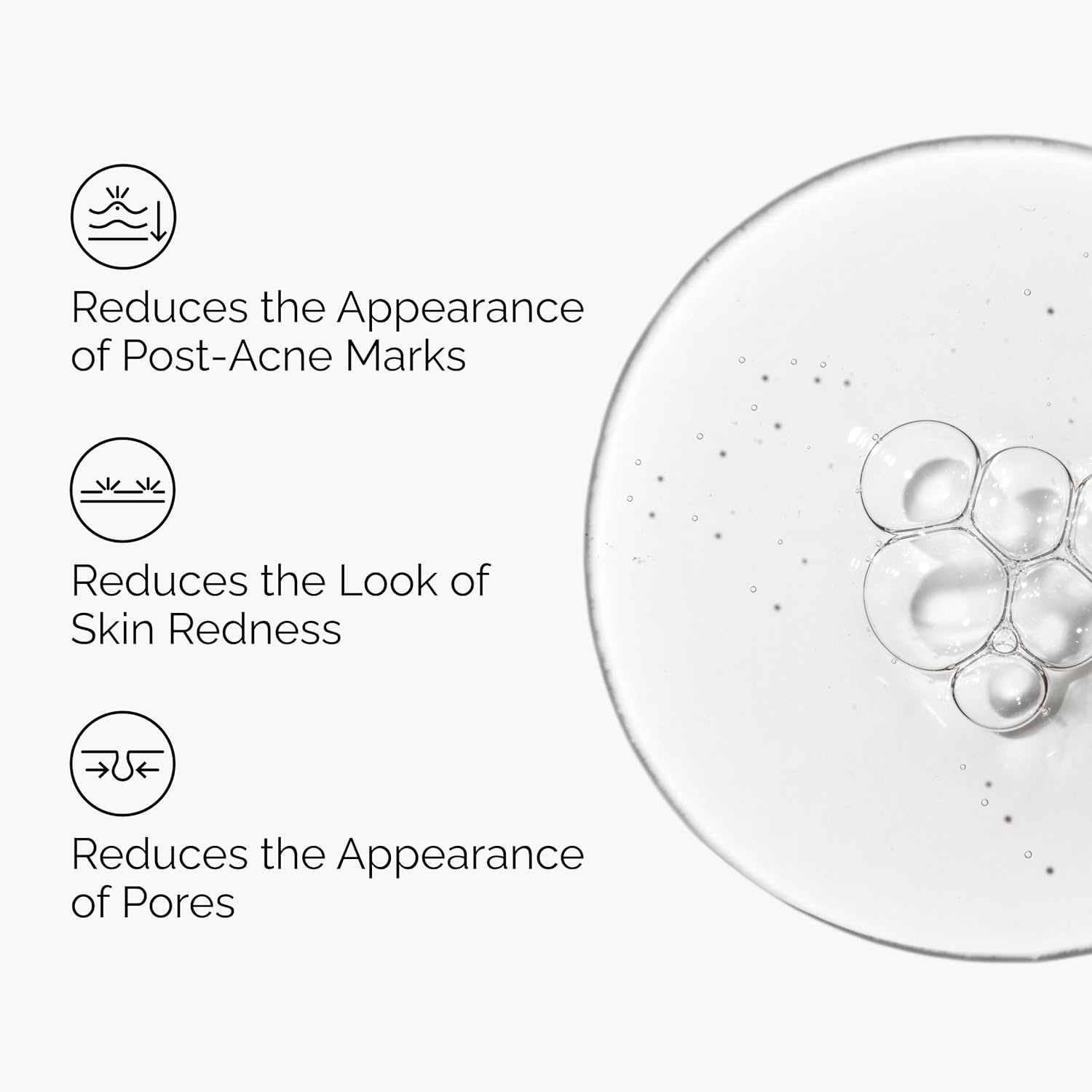 The Ordinary Aloe 2% + NAG 2% Solution, Soothes Skin and Targets Post-Acne Marks, 1 Fl Oz - view 2