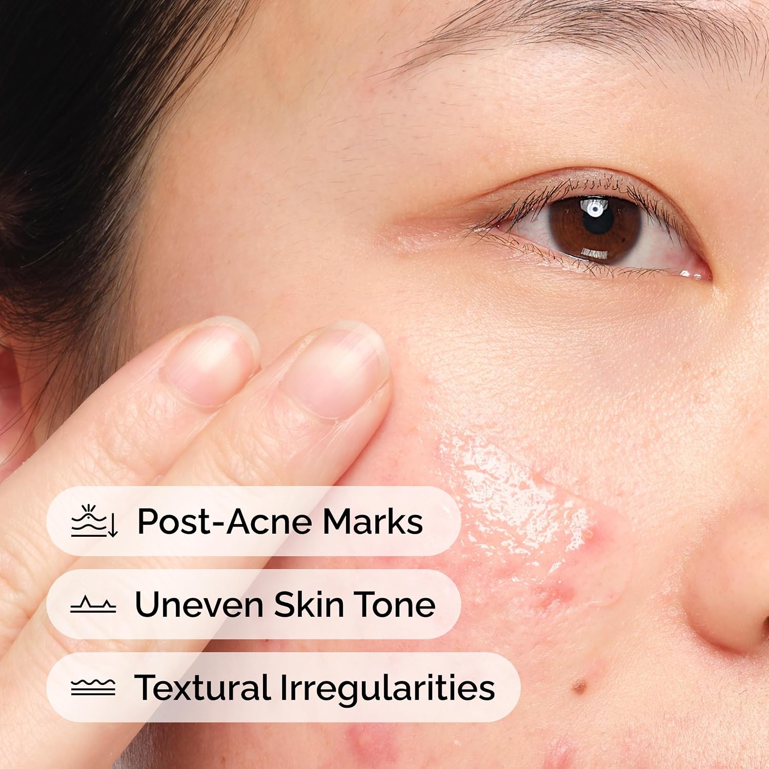 The Ordinary Aloe 2% + NAG 2% Solution, Soothes Skin and Targets Post-Acne Marks, 1 Fl Oz - view 3