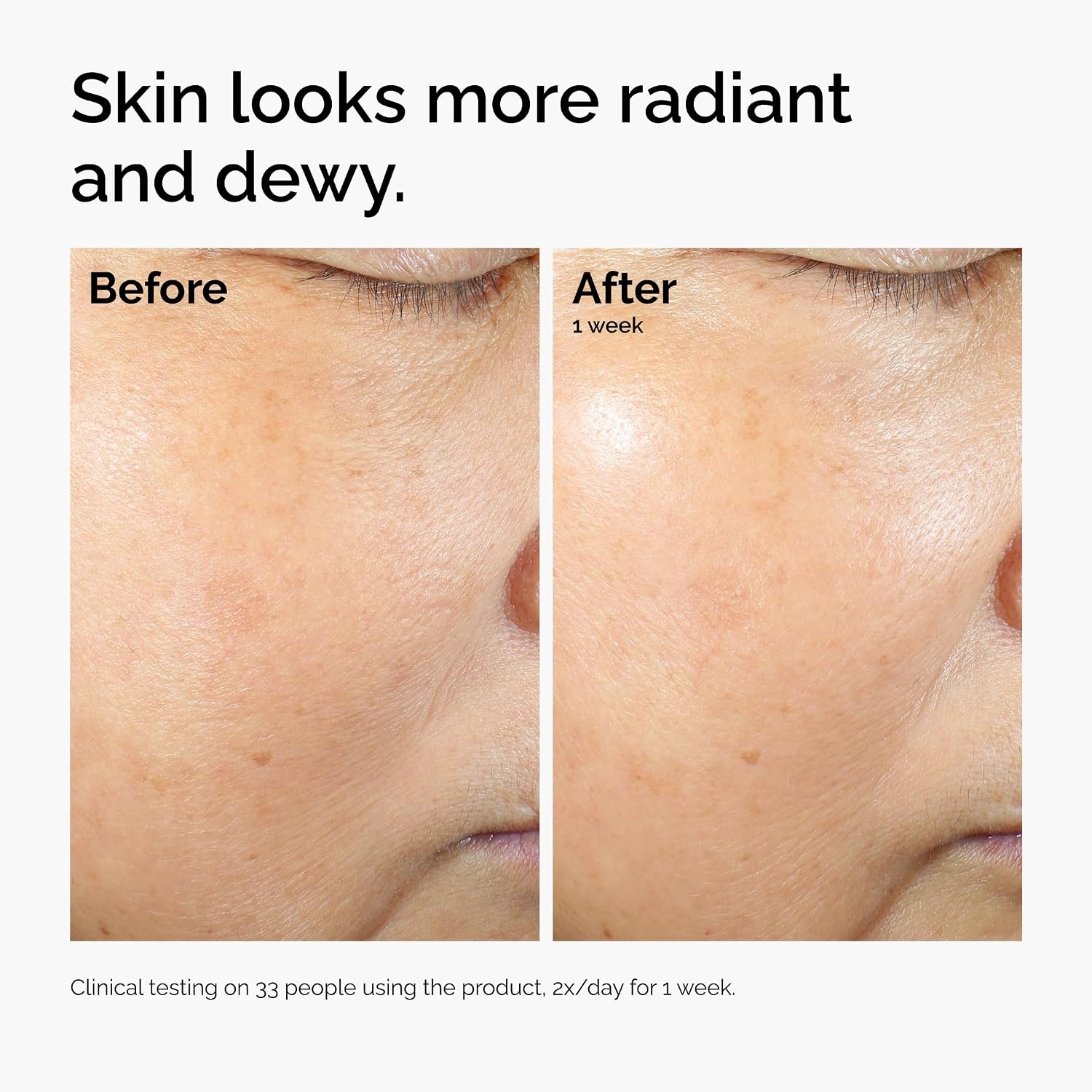 The Ordinary Rice Lipids + Ectoin Microemulsion Moisturizer for Dry Skin, Soothing Hydration, Barrier Repair, Reduced Redness(4 Fl Oz (Pack of 1)) - view 5