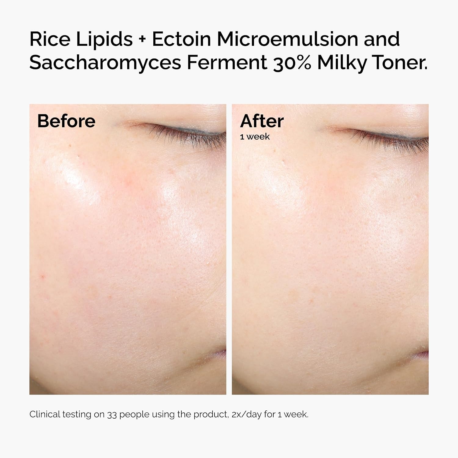 The Ordinary Rice Lipids + Ectoin Microemulsion Moisturizer for Dry Skin, Soothing Hydration, Barrier Repair, Reduced Redness(4 Fl Oz (Pack of 1)) - view 6